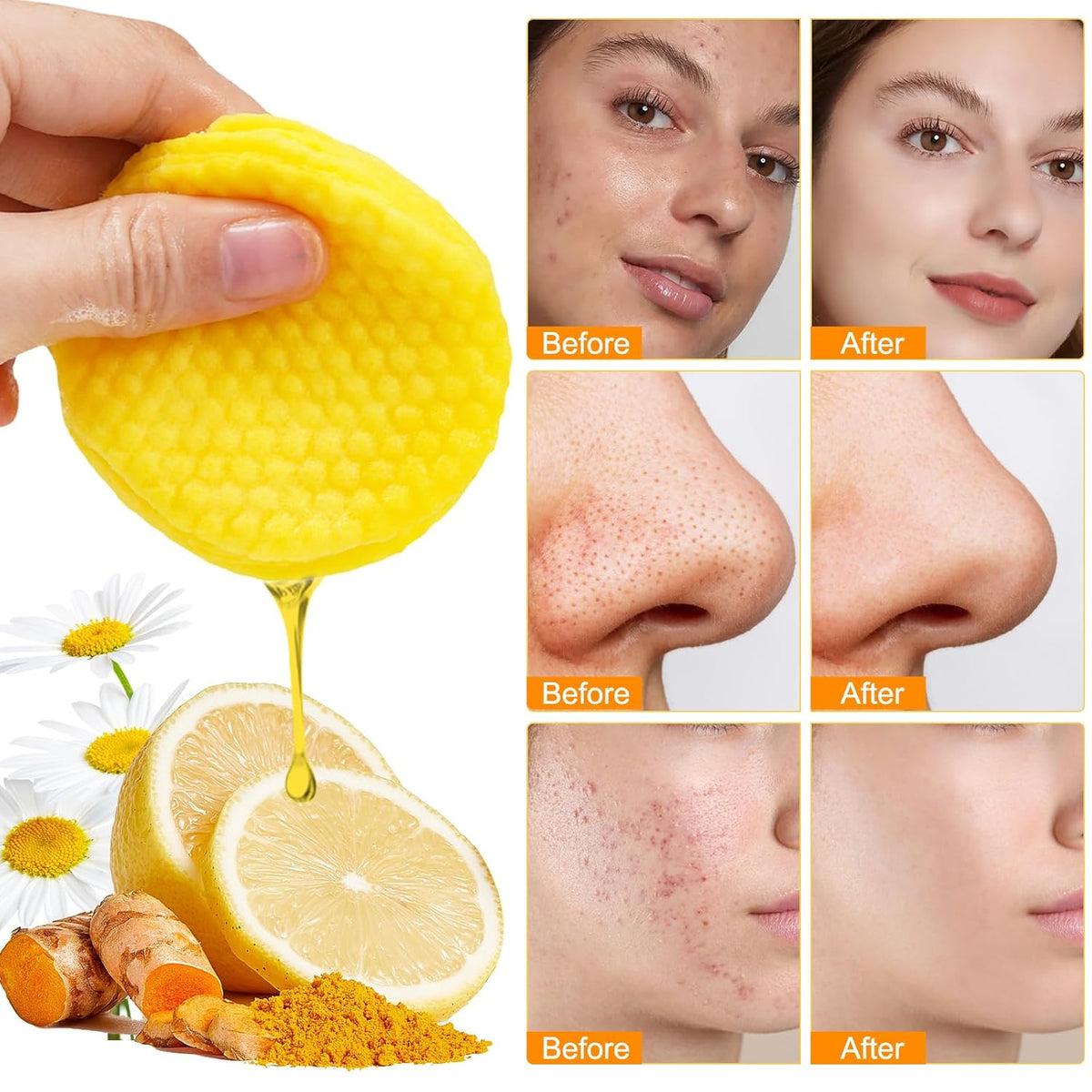 Turmeric Kojic Acid Vitamin C Exfoliating Pads - 50 Count for Oil Control, Hydration & Dullness Reduction - Face & Body Cleansing Pads